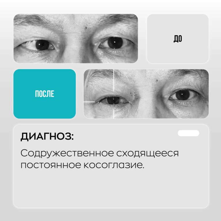 Сеть глазных клиник ASTANA VISION. Клиника в г. Караганда. https://karaganda.vision.kz/