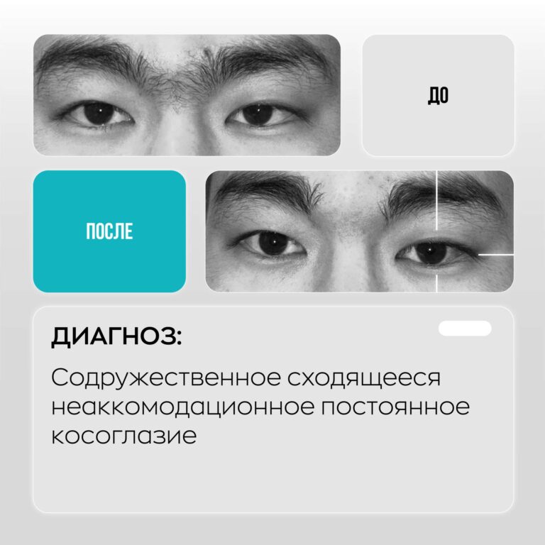 Сеть глазных клиник ASTANA VISION. Клиника в г. Караганда. https://karaganda.vision.kz/