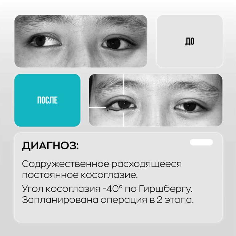 Сеть глазных клиник ASTANA VISION. Клиника в г. Караганда. https://karaganda.vision.kz/