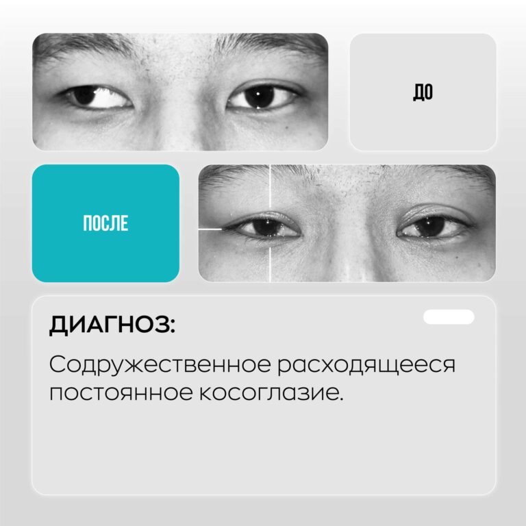 Сеть глазных клиник ASTANA VISION. Клиника в г. Караганда. https://karaganda.vision.kz/
